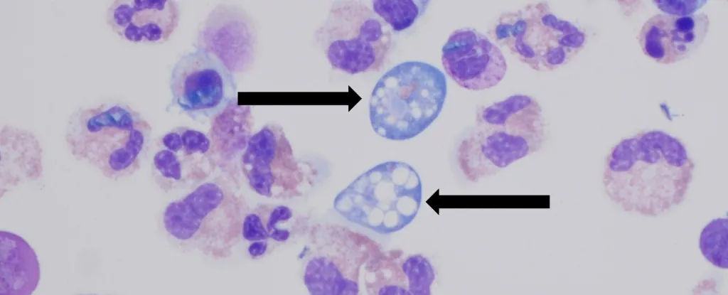 Naegleria-_1749135646.webp